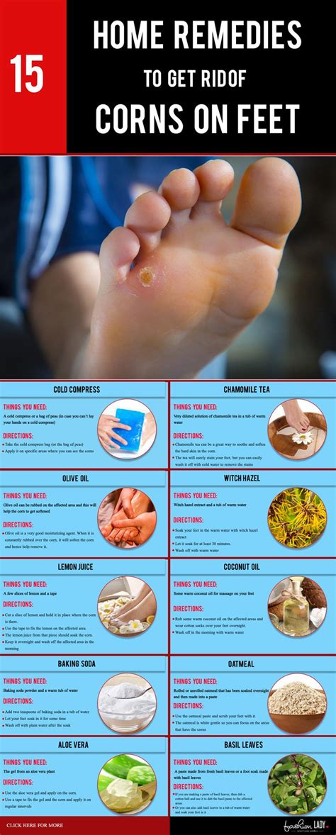 15 Home Remedies To Get Rid Of Corns On Feet Get Rid Of Corns Get Rid Of Warts Foot Remedies