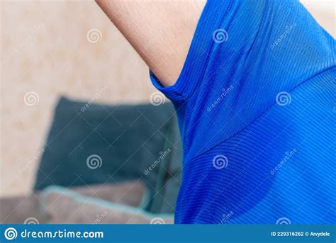Man With Hyperhidrosis Sweating Very Badly Under Armpitman Sweating