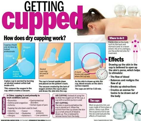 Getting Cupped Cupping Treatment Cupping Massage Cupping Therapy