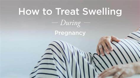 Swollen Hands During Pregnancy Natural Treatments