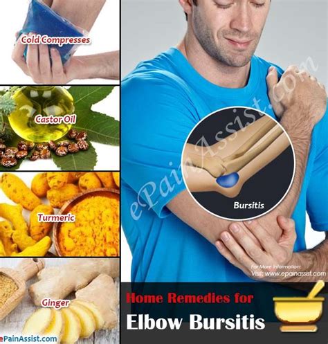 Home Remedies For Elbow Bursitis Bursitis Elbow Home Remedies For