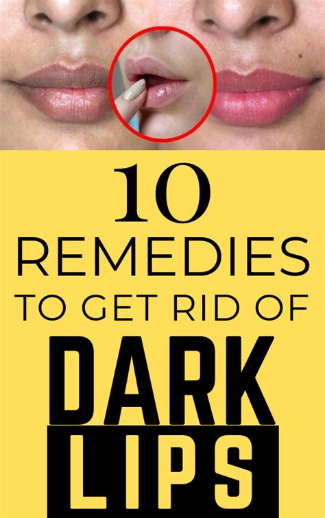 10 Very Effective Home Remedies For Dark Lips Con Imágenes