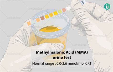 एमएमए मिथाइल मेलोनिक एसिड यूरिन टेस्ट क्या है खर्च कब क्यों कैसे होता है methylmalonic