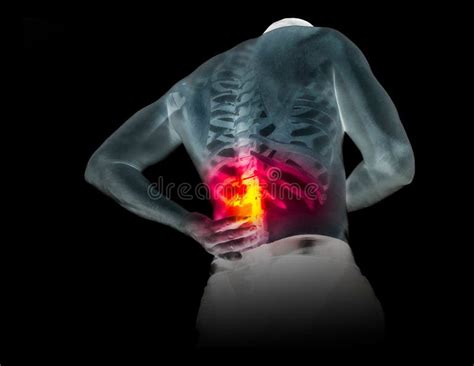 Human Skeleton Under The X Rays Isolated On Black Background Stock Illustration Illustration