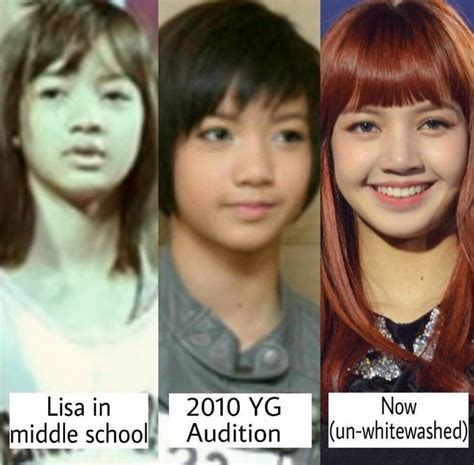 Lisa Before Blackpink These Are Her Surgeries En 2023 Cantantes