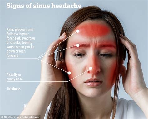 Not All Headaches Feel The Same Handy Picture Guide Shows