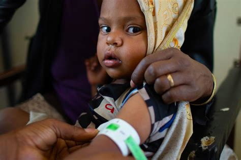 100 Mil Crianças Correm Risco De Morte Por Desnutrição Em Tigray Na Etiópia As Nações Unidas