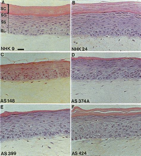 Histology Of Skin Reconstructed In Vitro From Normal And Xp C