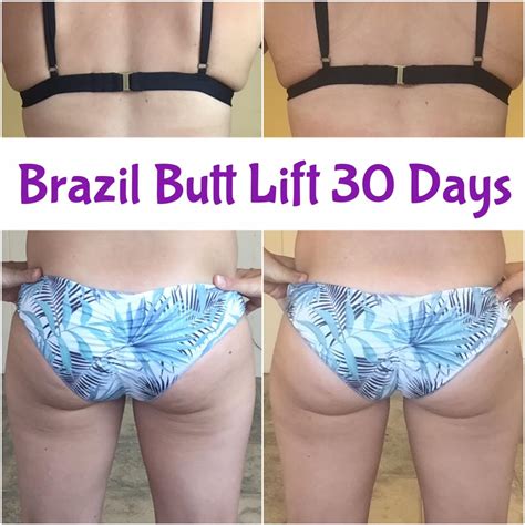 brazilian butt lift workout before and after loxamex