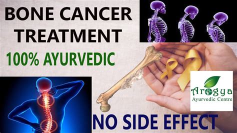 Bone Cancer Causes Types Effects Symptoms Treatment Youtube