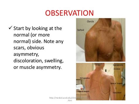 Shoulder Pathomechanics