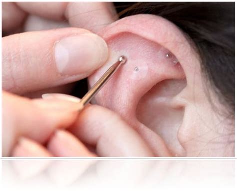 Ear Seeds Ear Seeds Ear Acupressure Points Ear