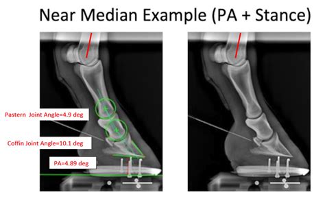 The Truth About Hoof Pastern Axis