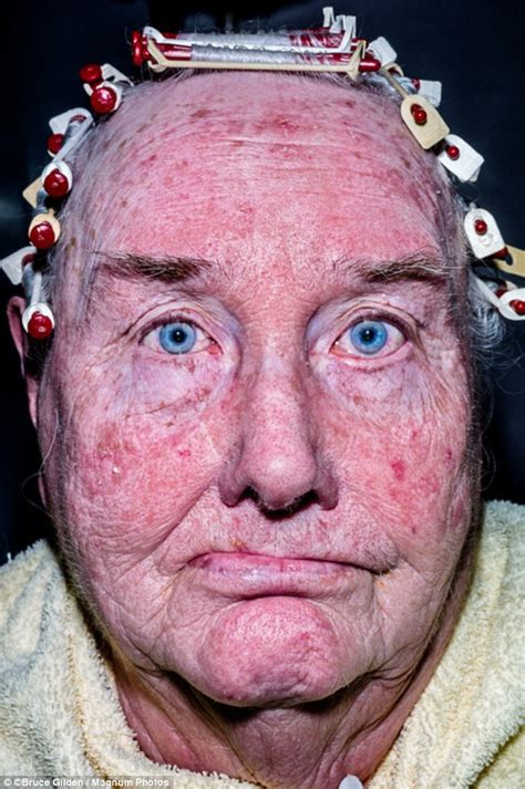 Photographer Takes Snaps Of Real People With Battered And Bruised