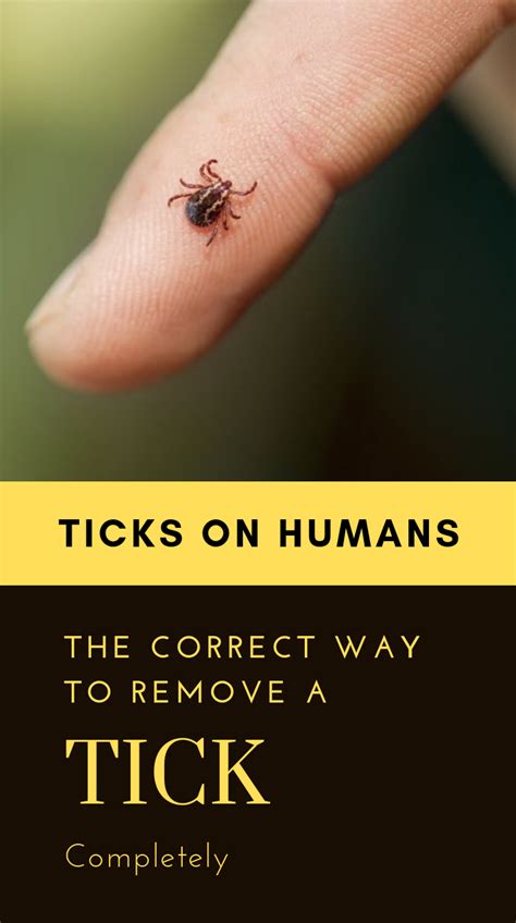 How To Remove A Tick From A Human 2022 At How To