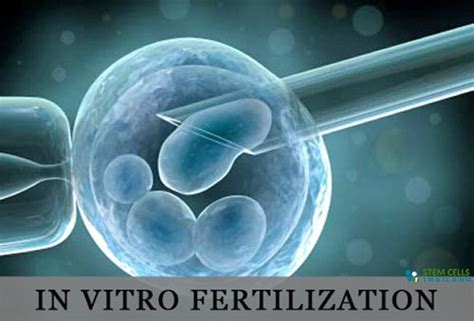 In Vitro Fertilization Artificial Insemination And Ivf Screening
