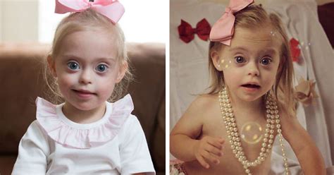 2 Year Old Girl With Down Syndrome Wins Modeling Contract Thanks To Her