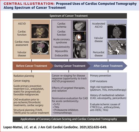 Cardiac Computed Tomography In Cardio Oncology Jacc Cardiooncology