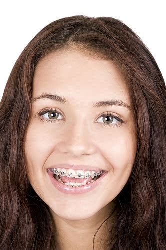 Misconceptions About Orthodontics Pacific Northwest Orthodontics