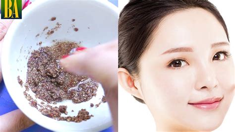 How To Get Rid Of Pitted Acne Marks Naturally In A Week Remove