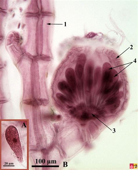Life Cycle Of Polysiphonia Rhodophyta Red Algae