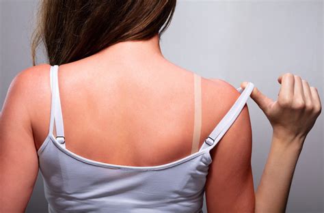 5 dermatologist secrets to save your summer solrx sunscreen
