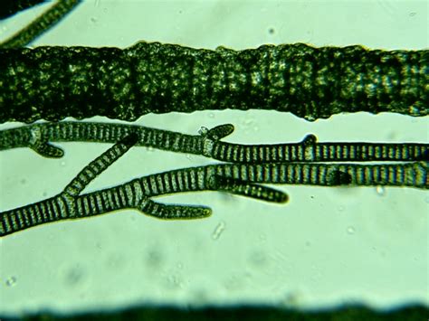 Microgalleryro Algele Verzi Albastre Cianobacterii
