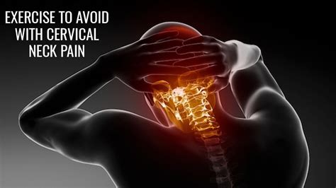 Exercises To Avoid With Cervical Neck Pain Youtube