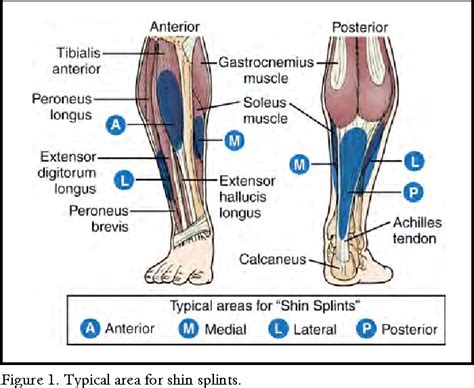 Pdf Medial Tibial Stress Syndrome Semantic Scholar