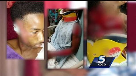 Heartbroken Mother Speaks Out After Son Injured In Hit And Run Crash