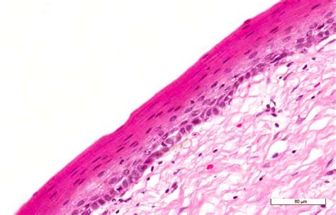 Epitelio Plano Estratificado