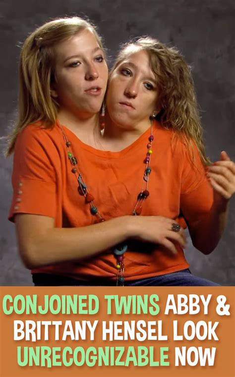 Conjoined Twins Abby And Brittany Hensel Look Unrecognizable Now