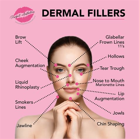 Dermal Fillers Perfect Aesthetics Plymouth