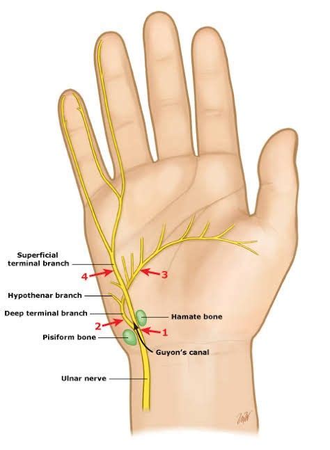 Ulnar Nerve Branches In The Hand Nerve Anatomy Ulnar Nerve Medical