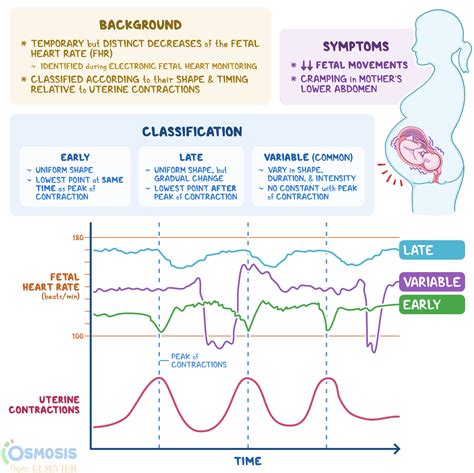 Fetal Decelerations What Is It Causes And More Osmosis