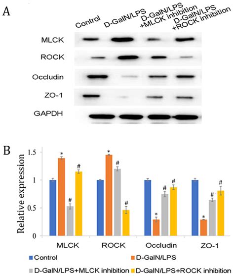 Tight Junction Protein Expression Levels In The Control D Galn Lps