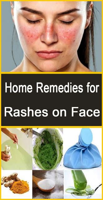 Home Remedies For Rashes On Face Beauties Natural Rash On Face