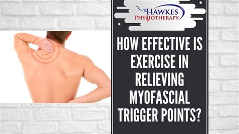 How Effective Is Exercise In Relieving Myofascial Trigger Points