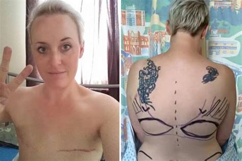 Cancer Mum Shows Off Chest After Double Mastectomy Daily Star