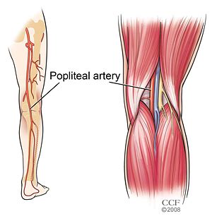 Popliteal Artery Stepwards