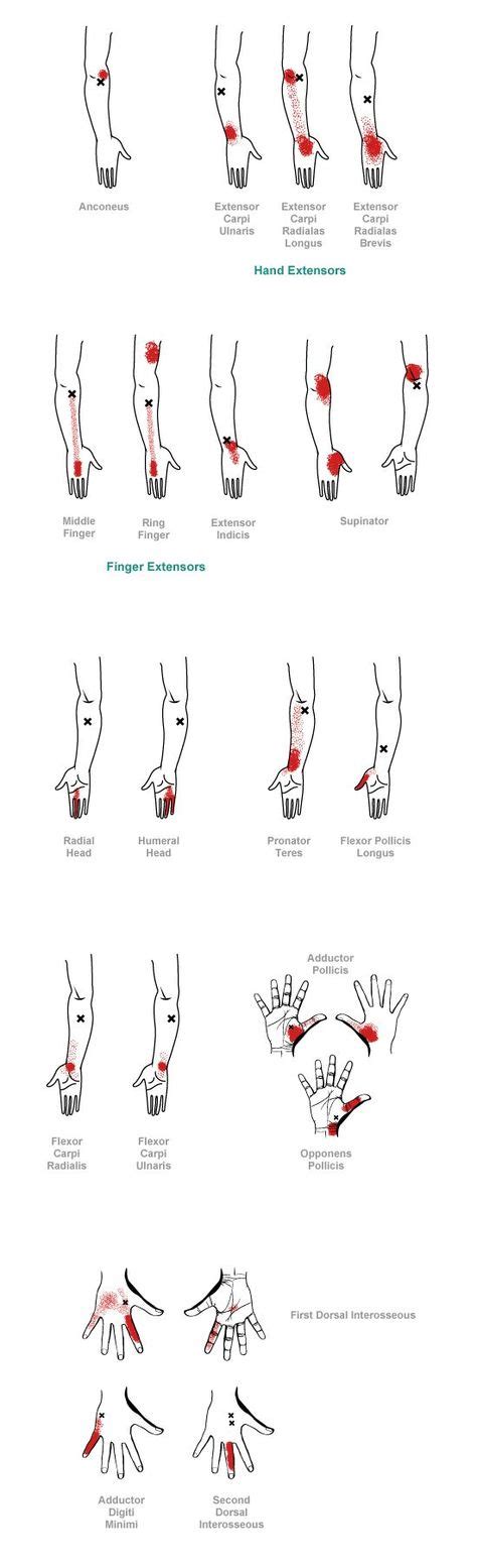 8 Muscle Knots Ideas Trigger Points Trigger Point Therapy Massage Therapy