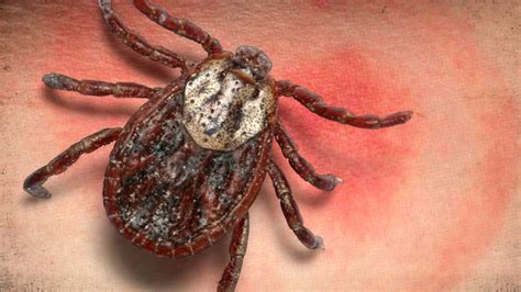 Lyme Diseases Cases On The Rise In West Virginia Wowk 13 News