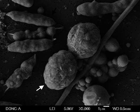 Scanning Electron Microscope Imaging Of Chlamydospores Converted From