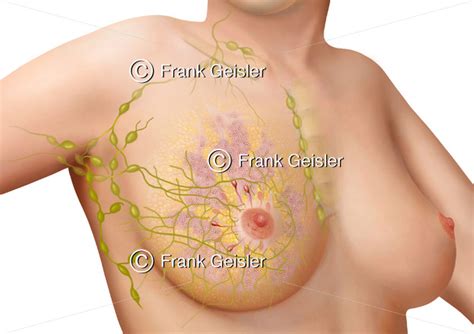 Anatomie Brustdrüse mit Drüsenlappen und Milchgänge Lymphgefäße und Lymphknoten der weiblichen
