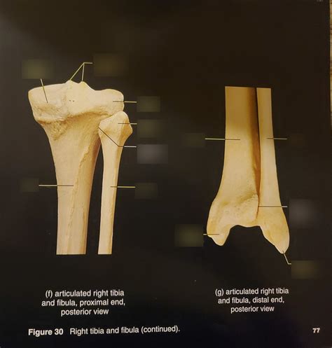 Articulated Right Tibia And Fibula Posterior View Diagram Quizlet