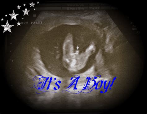 16 Week Boy Ultrasound Page 1 Babycenter