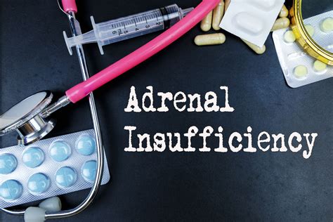 Unveiling The 10 Symptoms Of Adrenal Insufficiency Facty Health
