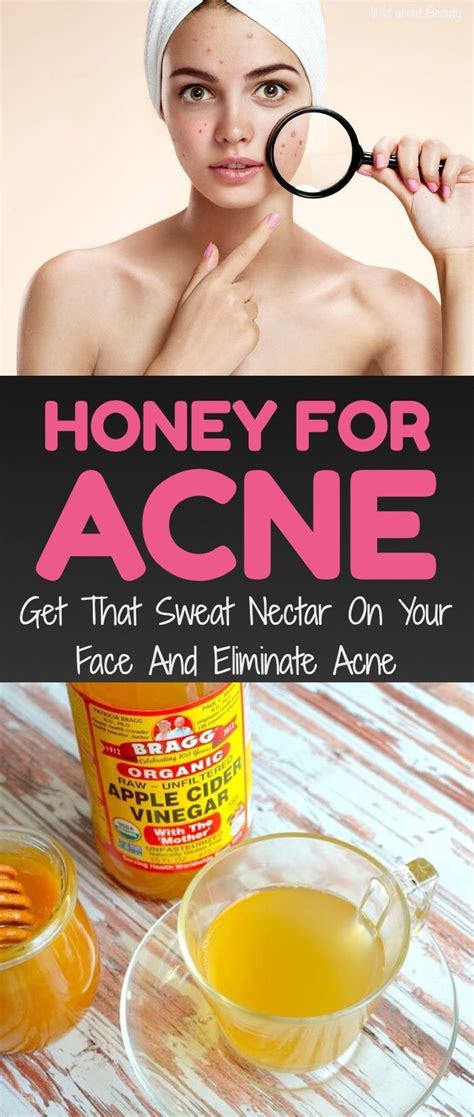 Honey For Acne Get That Sweat Nectar On Your Face And Eliminate Acne