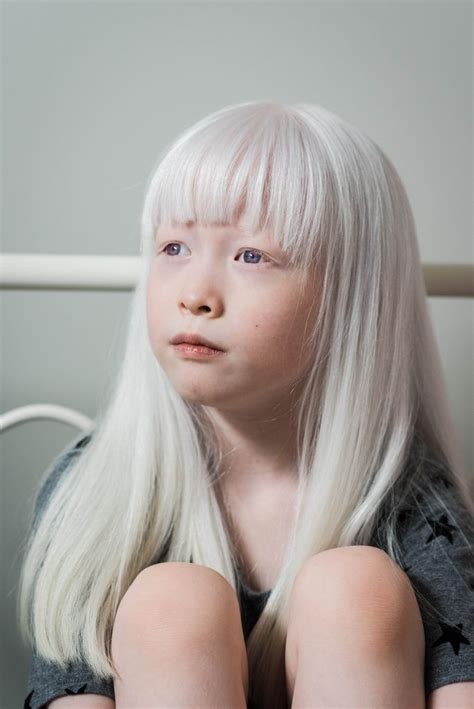 Pin By Mozibake On Ideoita Albinism Albino Girl Albino Model