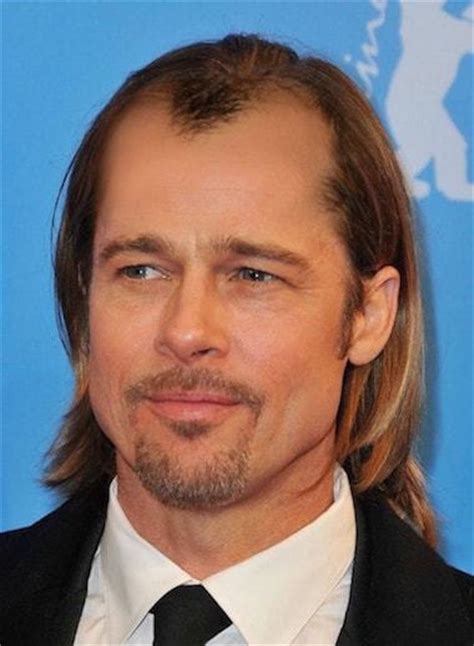 Hairless Hollywood Brad Pitt Hair Transplants Los Angeles And San